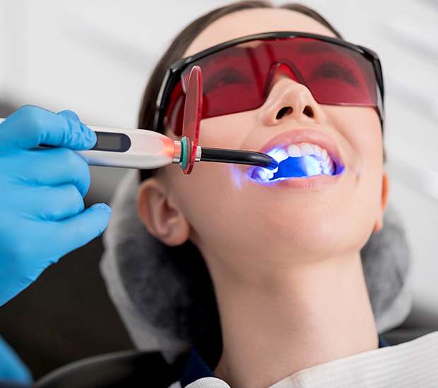 Fairfield Professional Teeth Whitening